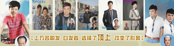 TOPDS頂上補(bǔ)發(fā)