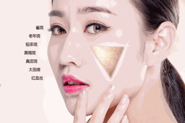 朱迪夫人祛痘祛斑