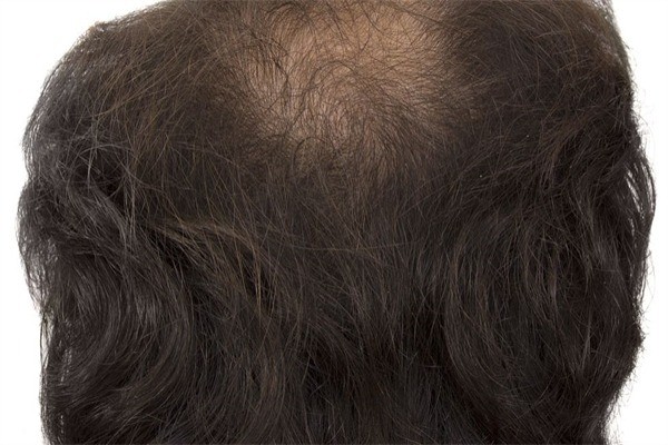 貞善坊養(yǎng)發(fā)