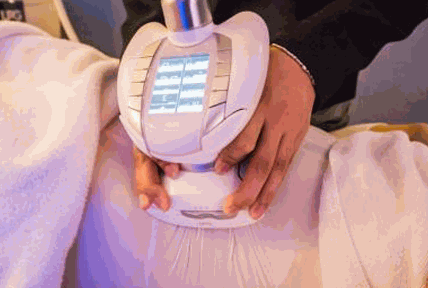 蜜齡產(chǎn)后修復(fù)