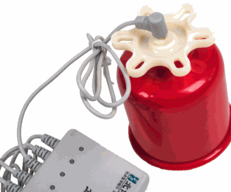 北博遠(yuǎn)紅外拔罐