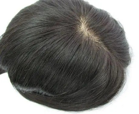 織發(fā)補發(fā)