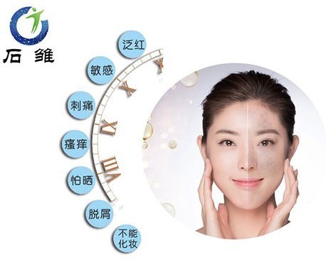 石初專業(yè)祛痘祛斑