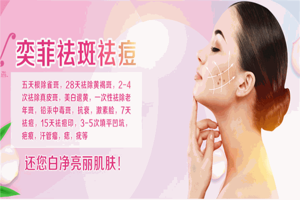 奕菲祛斑祛痘