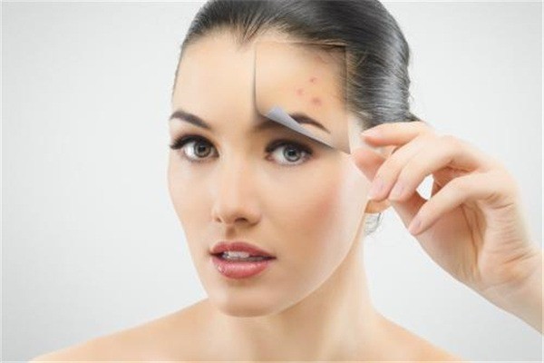 皇莎醫(yī)美祛痘祛斑