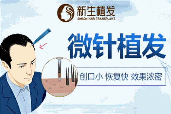 新生植發(fā)