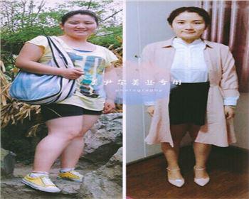 美尹爾國際減肥塑形養(yǎng)生