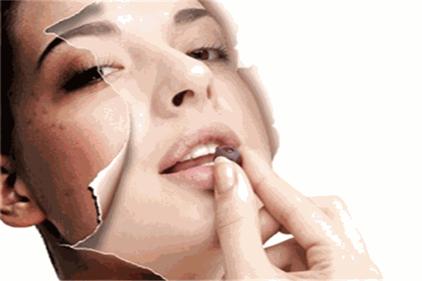 艾菲媛祛斑祛痘