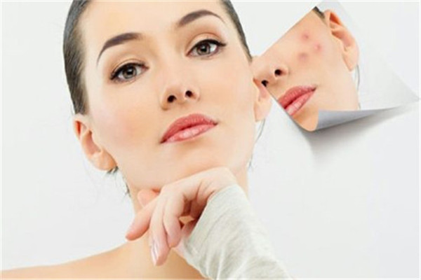 苗芳科顏專業(yè)祛痘