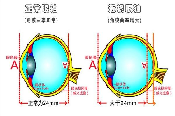 博視頓視力康復中心