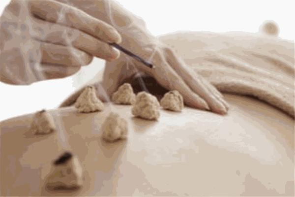 千年炙艾炙養(yǎng)生堂