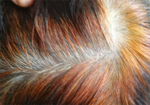 田之緣植物養(yǎng)發(fā)